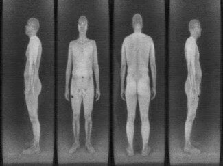 news-body-scanner