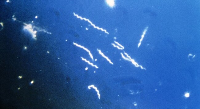 Borrelia burgdorferi is the spirochete, a spiral-shaped bacterium, that causes Lyme Disease.